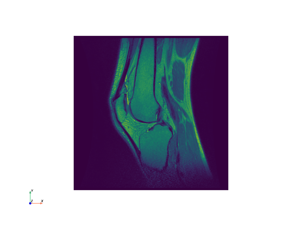 ../../_images/pyvista-examples-downloads-download_knee-1_00_00.png