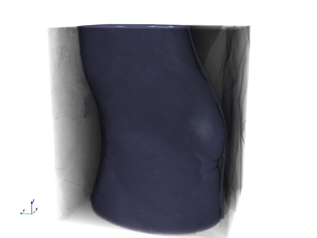 ../../_images/pyvista-examples-downloads-download_knee_full-1_00_00.png