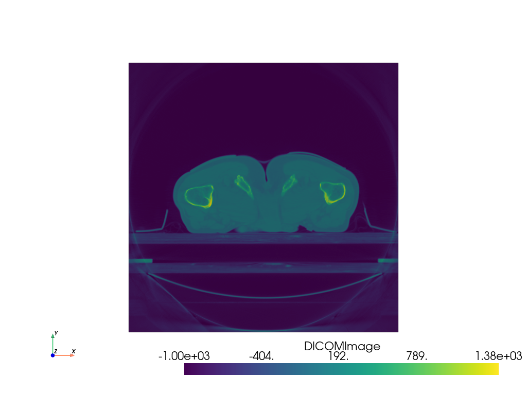 ../../_images/pyvista-examples-downloads-download_prostate-1_00_00.png